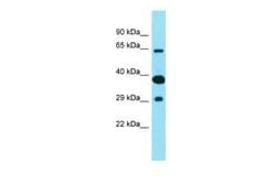FAM83D Rabbit anti-Human, Polyclonal, Novus Biologicals 100 &mu;g; Unconjugated:Antibodies,